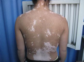 �_�o���ߌ^