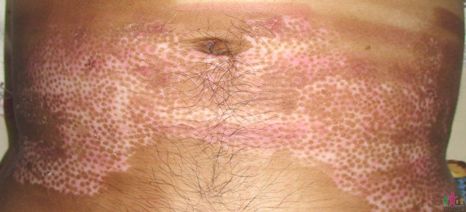 �q�퐫����