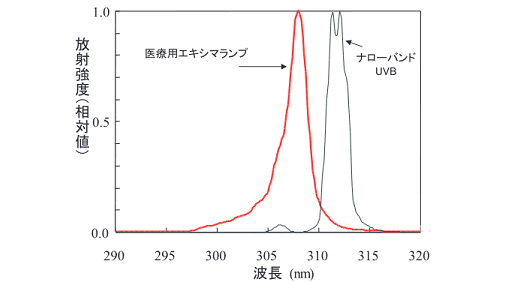ナローバンドUVB